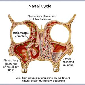 Sinusitis Fatigue - Sinus Headaches And Natural Remedies