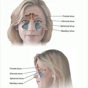 Sinuses Photos - Know The Symptoms Of A Sinus Infection In An Instant
