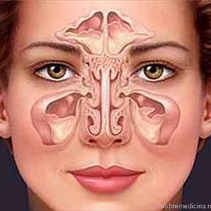 Burning Sinuses Eyes - Use A Sinus Infection Treatment That Suits You Best