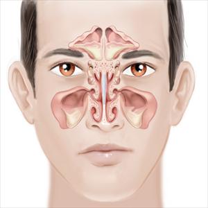 Sinus Cleansing - How To Cure Sinus Pain - Ways And Means To Cure Sinus Pain