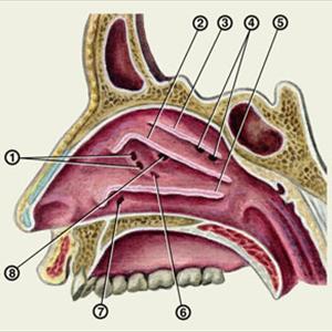 Sphenoid And Maxillary Sinuses - Major Symptoms Of Sinus Infection